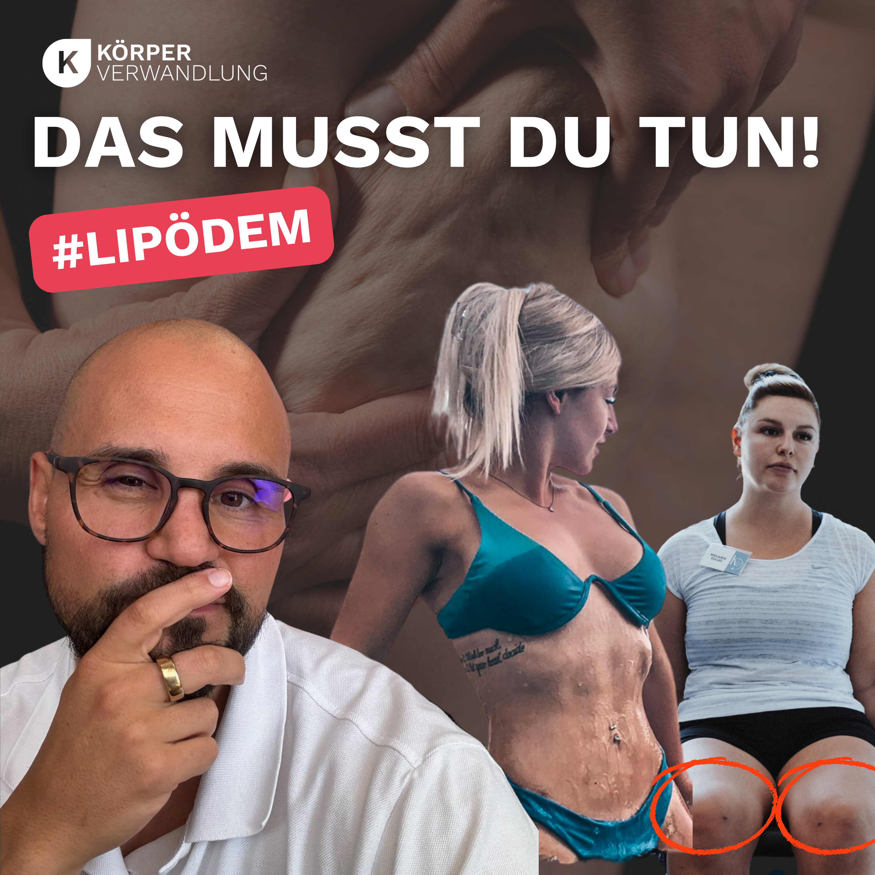 #167 Die Wahrheit über den Sommer mit Lipödem – das hilft wirklich gegen den Schmerz